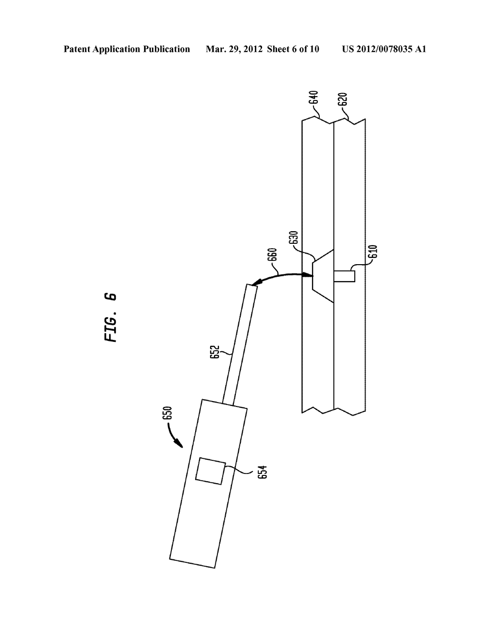 COVER FOR A BONE FIXTURE - diagram, schematic, and image 07