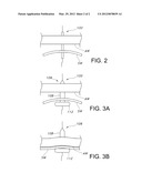 Dilation Device for Placing Catheter Tubes diagram and image