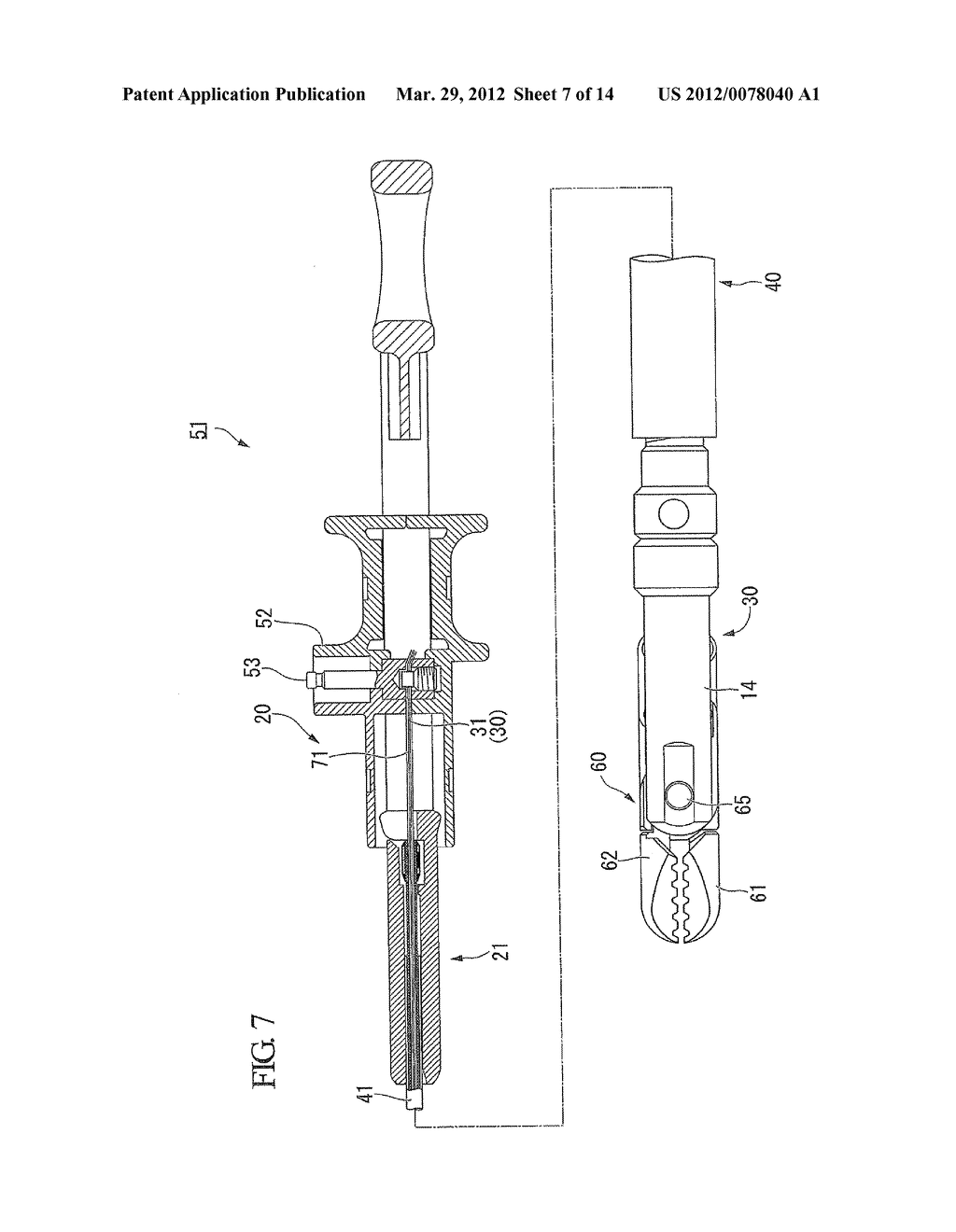 TREATMENT INSTRUMENT FOR ENDOSCOPE - diagram, schematic, and image 08