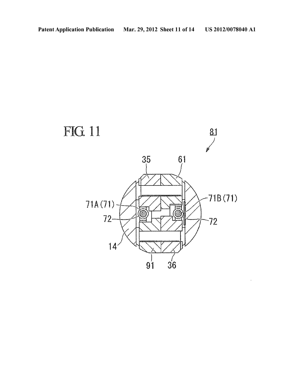 TREATMENT INSTRUMENT FOR ENDOSCOPE - diagram, schematic, and image 12