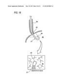 ENDOSCOPE SYSTEM, ENDOSCOPE IMAGE RECORDING APPARATUS, ENDOSCOPE IMAGE     ACQUISITION ASSISTING METHOD AND COMPUTER READABLE MEDIUM diagram and image