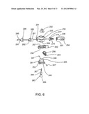 Method and Devices for Improved Tissue Stabilization diagram and image