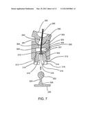 Method and Devices for Improved Tissue Stabilization diagram and image