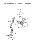 Method and Devices for Improved Tissue Stabilization diagram and image