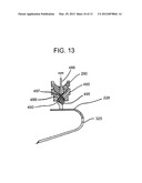 Method and Devices for Improved Tissue Stabilization diagram and image