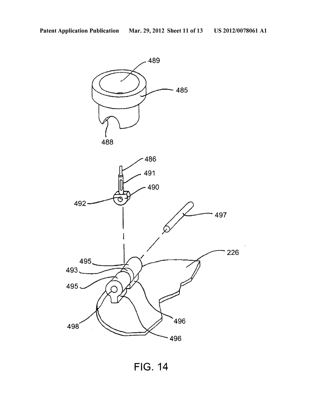 Method and Devices for Improved Tissue Stabilization - diagram, schematic, and image 12