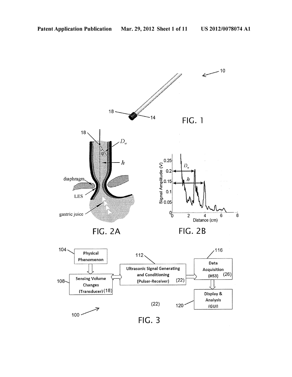 Methods and Apparatuses for Monitoring Gastroesophageal Reflux Volume with     Ultrasonic Catheter - diagram, schematic, and image 02