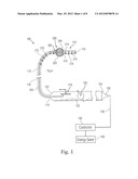 MEANS FOR SECURING A CATHETER INTO A VESSEL diagram and image