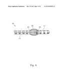 MEANS FOR SECURING A CATHETER INTO A VESSEL diagram and image