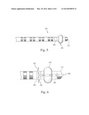 MEANS FOR SECURING A CATHETER INTO A VESSEL diagram and image