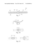 MEANS FOR SECURING A CATHETER INTO A VESSEL diagram and image