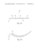 MEANS FOR SECURING A CATHETER INTO A VESSEL diagram and image