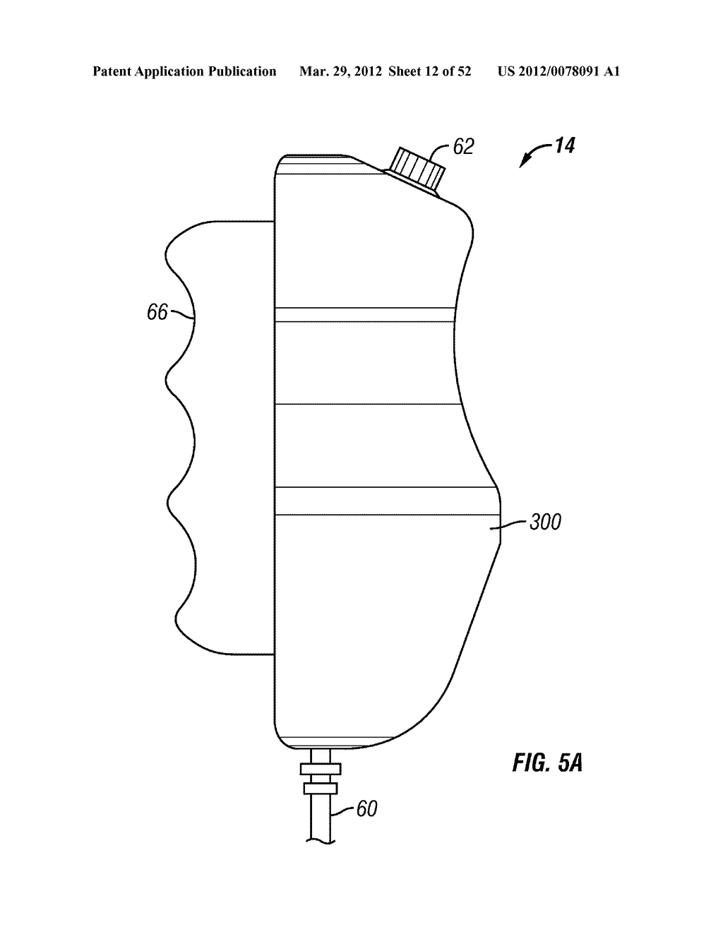 MEDICAL FLUID INJECTION SYSTEM - diagram, schematic, and image 13