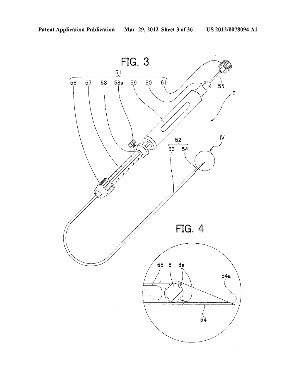 Ultrasound-Guided Ablation Method and Ultrasound-Guided Ablation System - diagram, schematic, and image 04