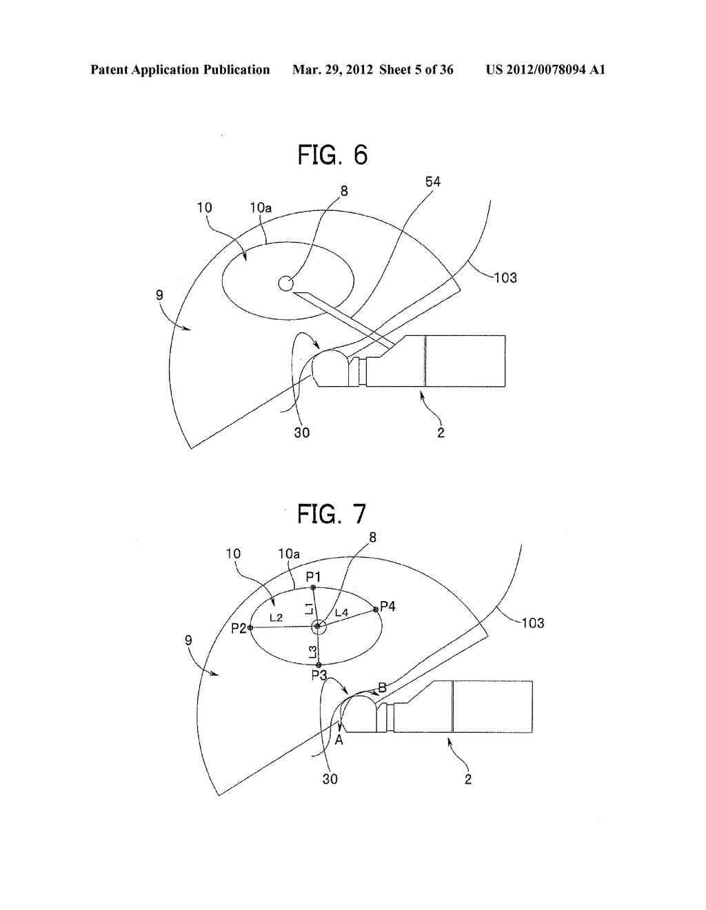 Ultrasound-Guided Ablation Method and Ultrasound-Guided Ablation System - diagram, schematic, and image 06