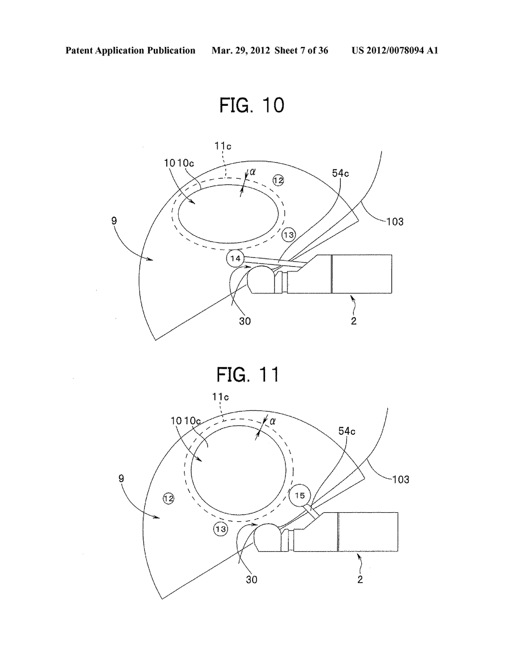 Ultrasound-Guided Ablation Method and Ultrasound-Guided Ablation System - diagram, schematic, and image 08