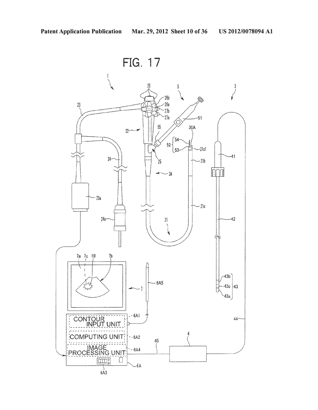 Ultrasound-Guided Ablation Method and Ultrasound-Guided Ablation System - diagram, schematic, and image 11