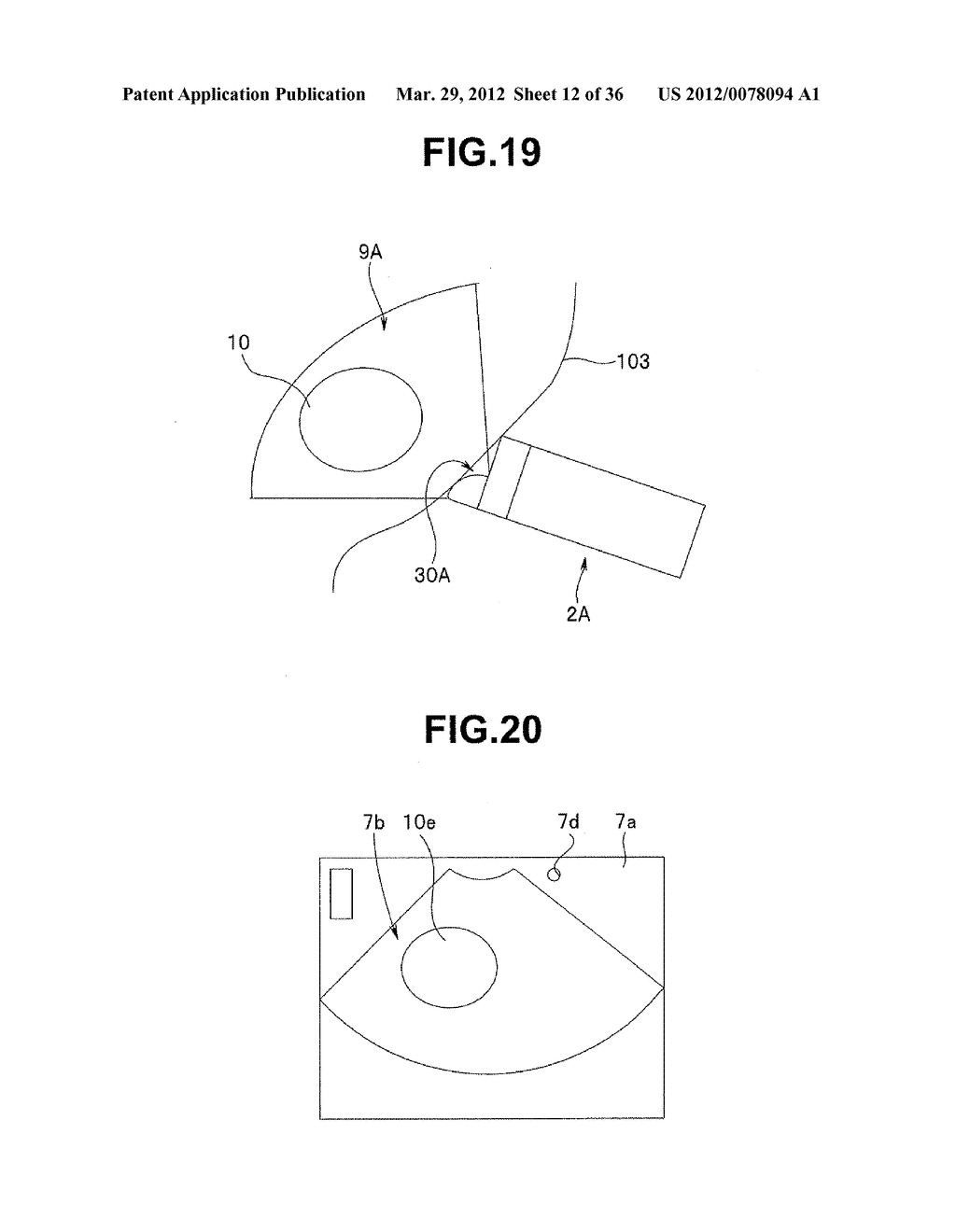 Ultrasound-Guided Ablation Method and Ultrasound-Guided Ablation System - diagram, schematic, and image 13