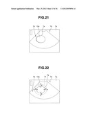 Ultrasound-Guided Ablation Method and Ultrasound-Guided Ablation System diagram and image