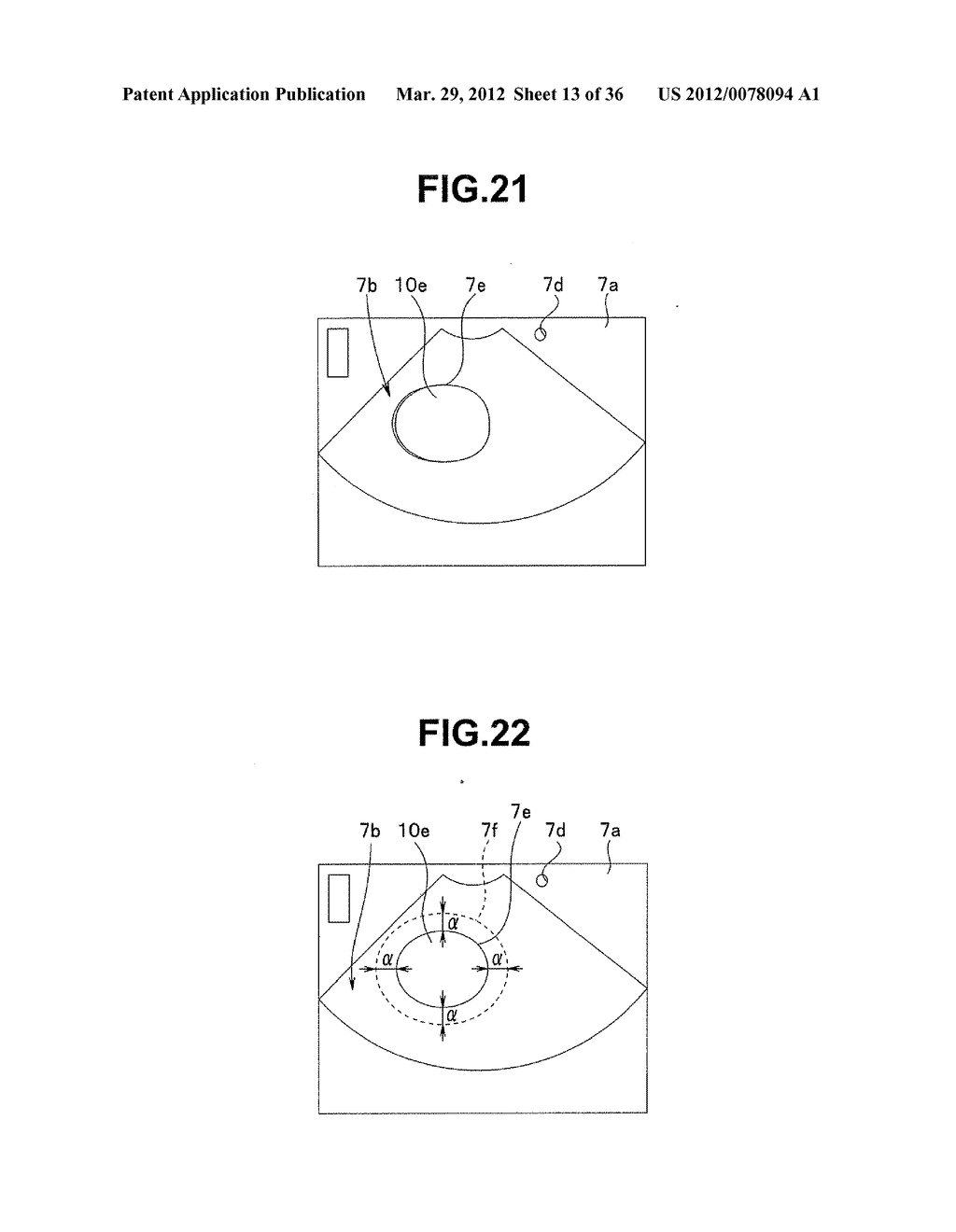 Ultrasound-Guided Ablation Method and Ultrasound-Guided Ablation System - diagram, schematic, and image 14