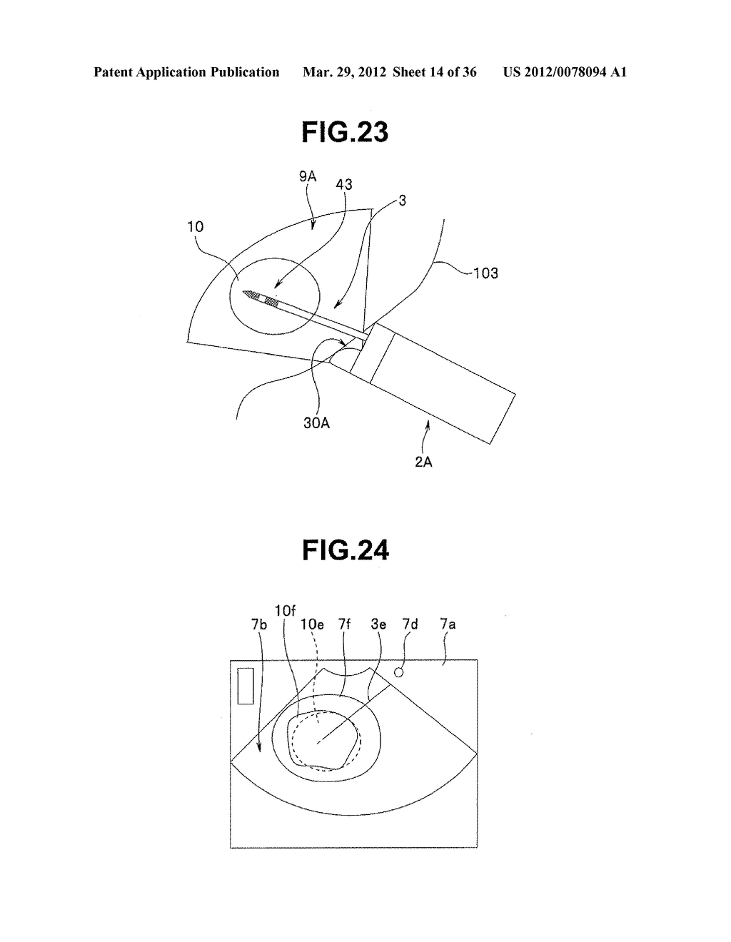 Ultrasound-Guided Ablation Method and Ultrasound-Guided Ablation System - diagram, schematic, and image 15