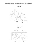 Ultrasound-Guided Ablation Method and Ultrasound-Guided Ablation System diagram and image