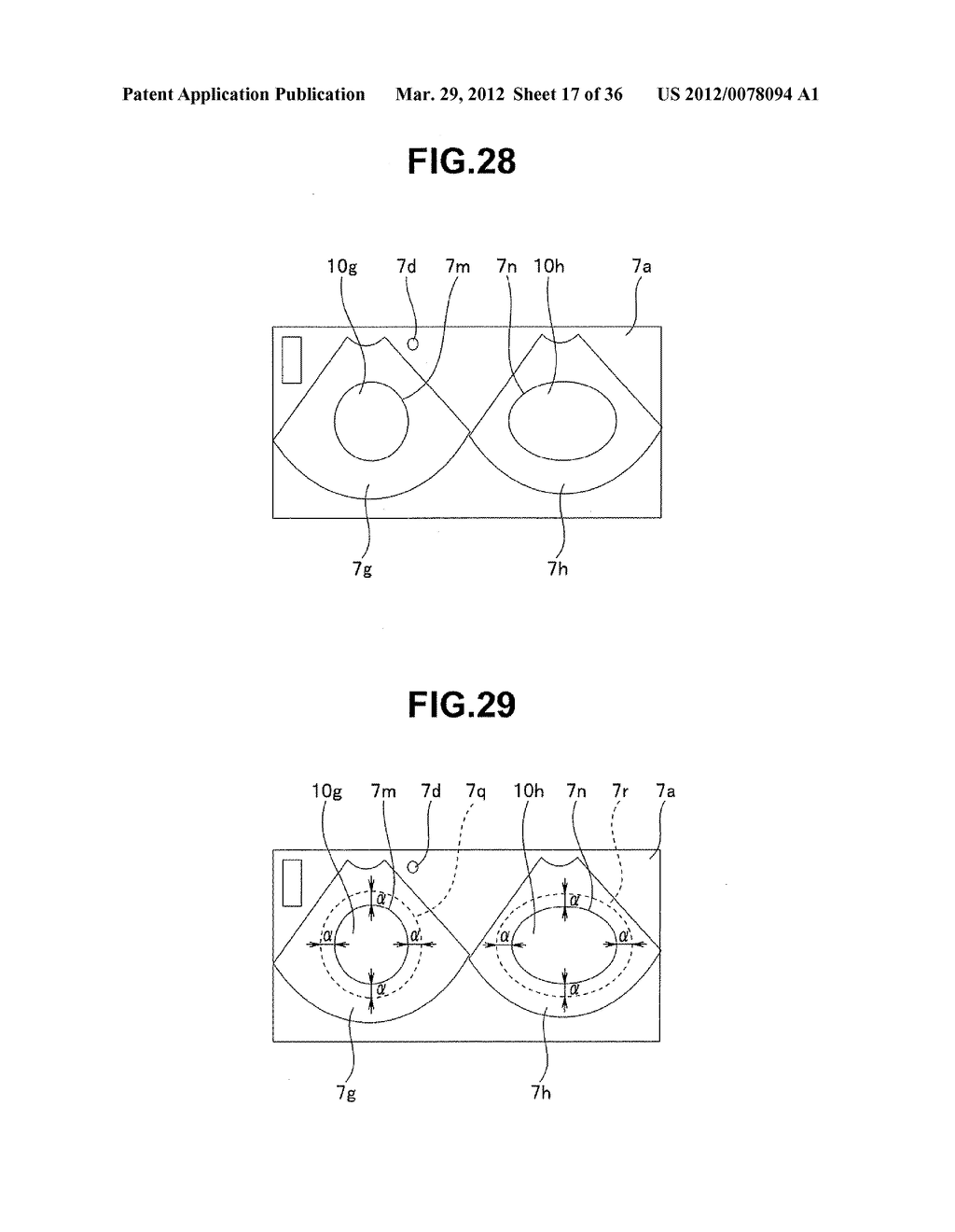 Ultrasound-Guided Ablation Method and Ultrasound-Guided Ablation System - diagram, schematic, and image 18