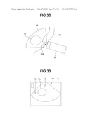 Ultrasound-Guided Ablation Method and Ultrasound-Guided Ablation System diagram and image