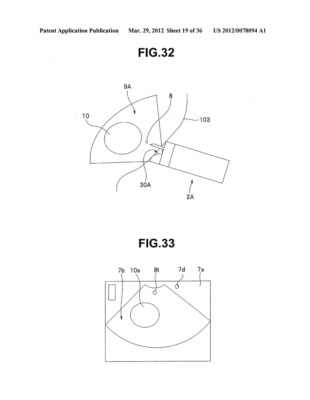 Ultrasound-Guided Ablation Method and Ultrasound-Guided Ablation System - diagram, schematic, and image 20