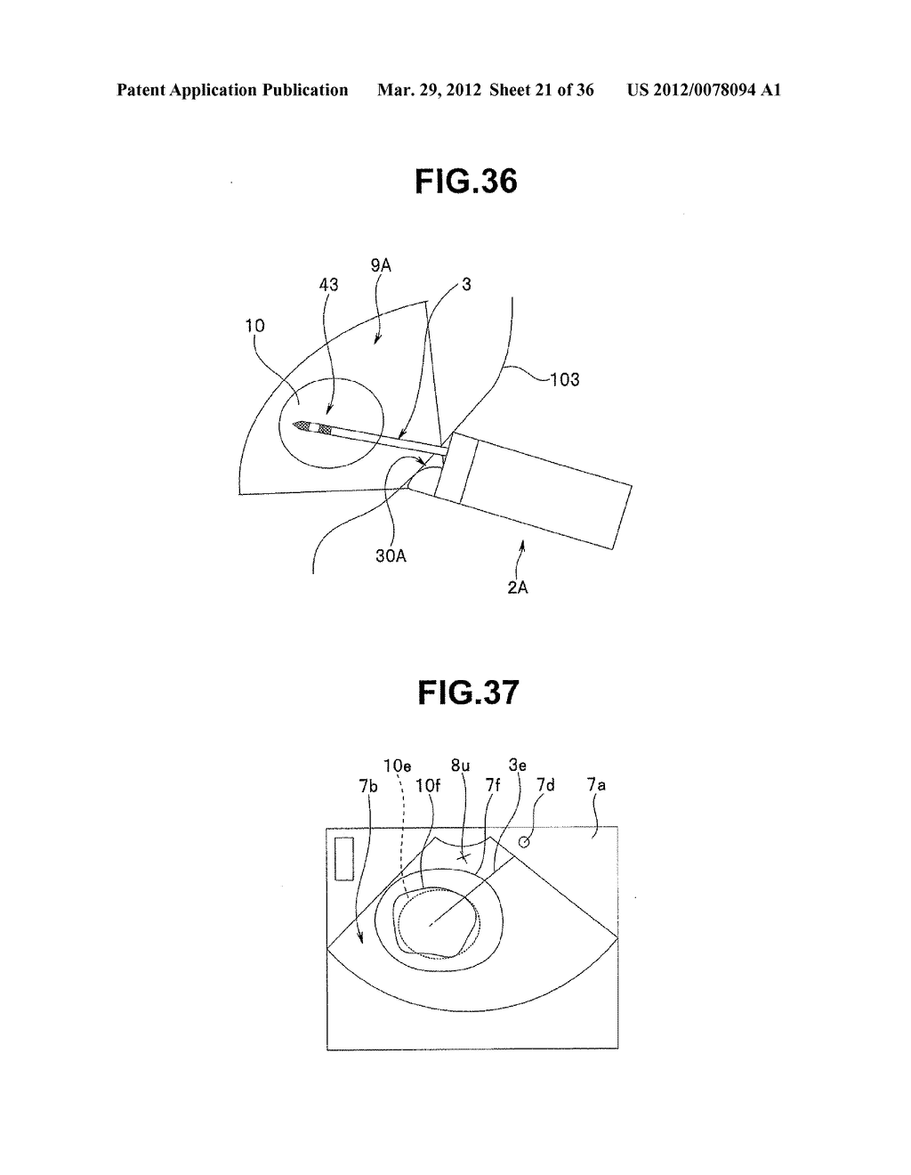 Ultrasound-Guided Ablation Method and Ultrasound-Guided Ablation System - diagram, schematic, and image 22