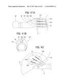 Ultrasound-Guided Ablation Method and Ultrasound-Guided Ablation System diagram and image