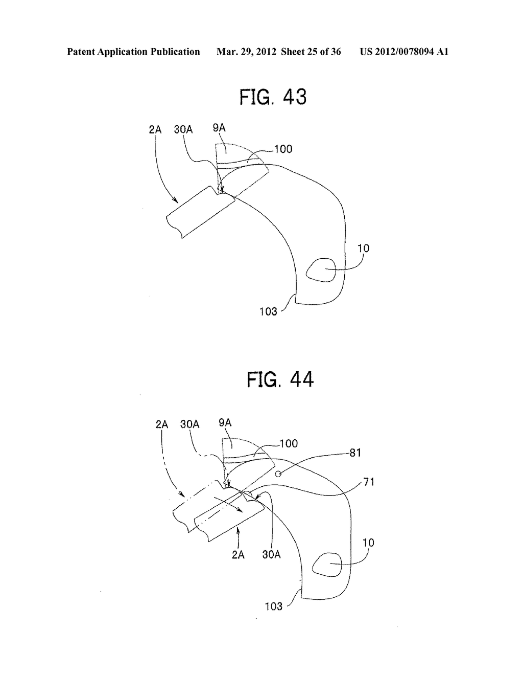 Ultrasound-Guided Ablation Method and Ultrasound-Guided Ablation System - diagram, schematic, and image 26