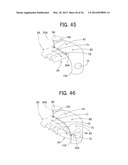 Ultrasound-Guided Ablation Method and Ultrasound-Guided Ablation System diagram and image