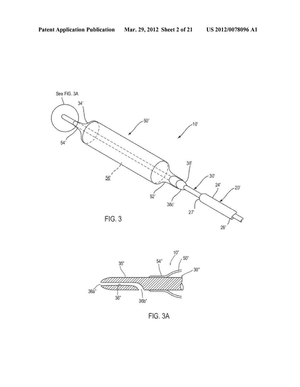 APPARATUS AND METHODS FOR TREATING OBSTRUCTIONS WITHIN BODY LUMENS - diagram, schematic, and image 03