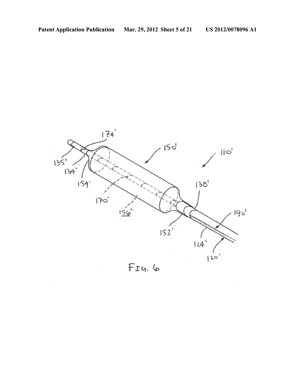 APPARATUS AND METHODS FOR TREATING OBSTRUCTIONS WITHIN BODY LUMENS - diagram, schematic, and image 06