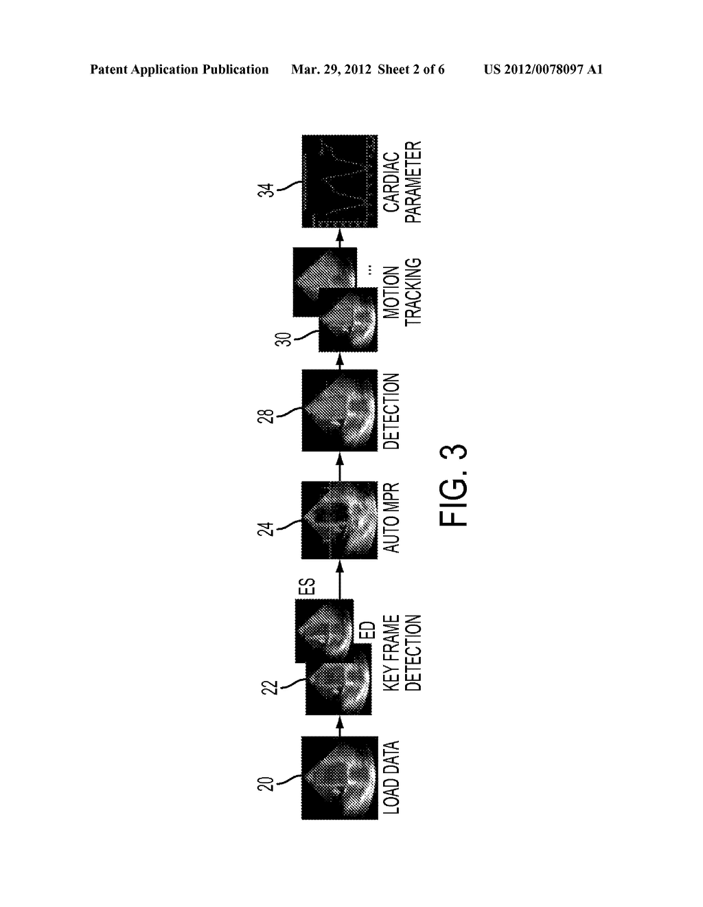 COMPUTERIZED CHARACTERIZATION OF CARDIAC MOTION IN MEDICAL DIAGNOSTIC     ULTRASOUND - diagram, schematic, and image 03