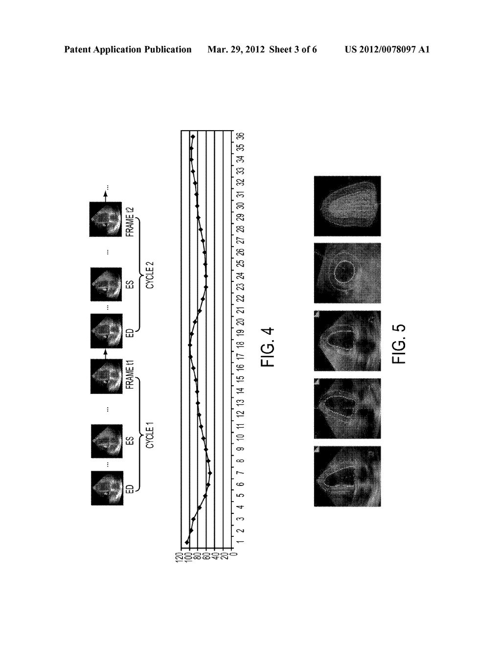 COMPUTERIZED CHARACTERIZATION OF CARDIAC MOTION IN MEDICAL DIAGNOSTIC     ULTRASOUND - diagram, schematic, and image 04