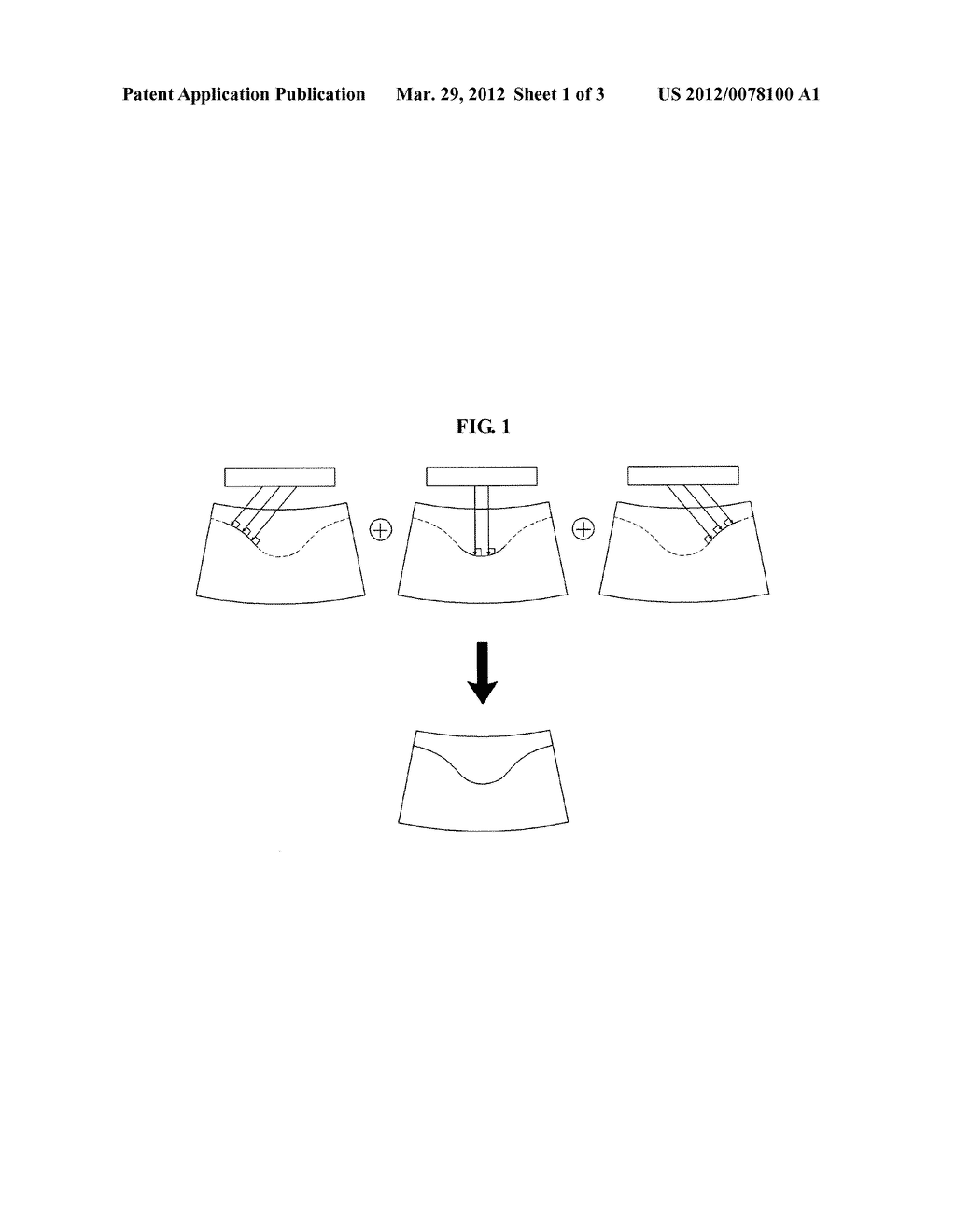 ULTRASOUND SYSTEM FOR COMBINING IMAGES OF VARIOUS ANGLES AND METHOD FOR     OPERATING ULTRASOUND SYSTEM - diagram, schematic, and image 02