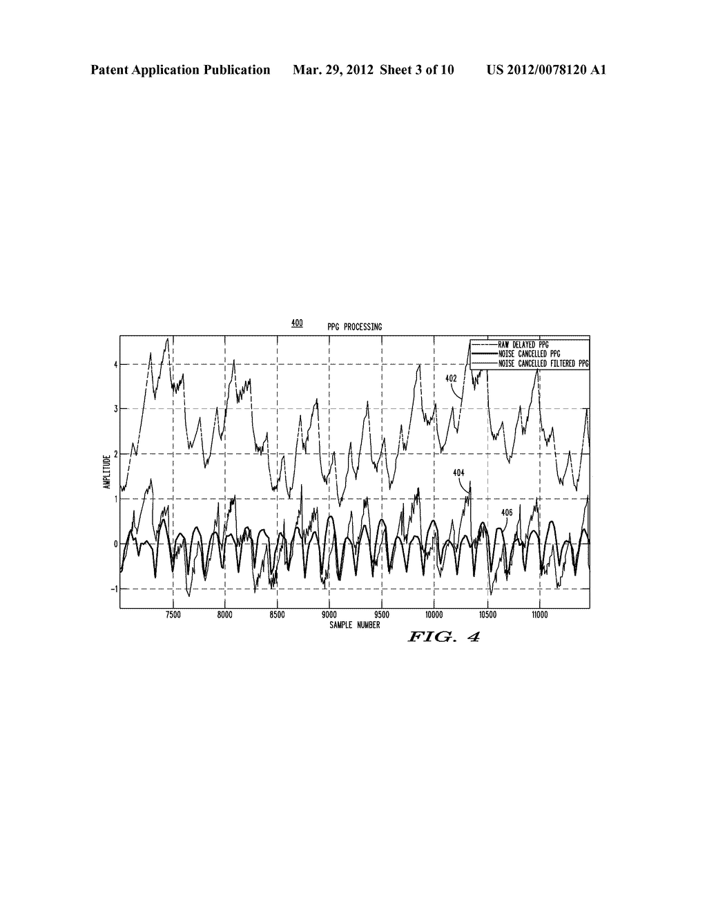 METHOD AND APPARATUS FOR ROBUST HEART RATE SENSING - diagram, schematic, and image 04