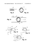 APPARATUS AND METHOD FOR SENSOR DEPLOYMENT AND FIXATION diagram and image