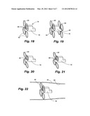 APPARATUS AND METHOD FOR SENSOR DEPLOYMENT AND FIXATION diagram and image