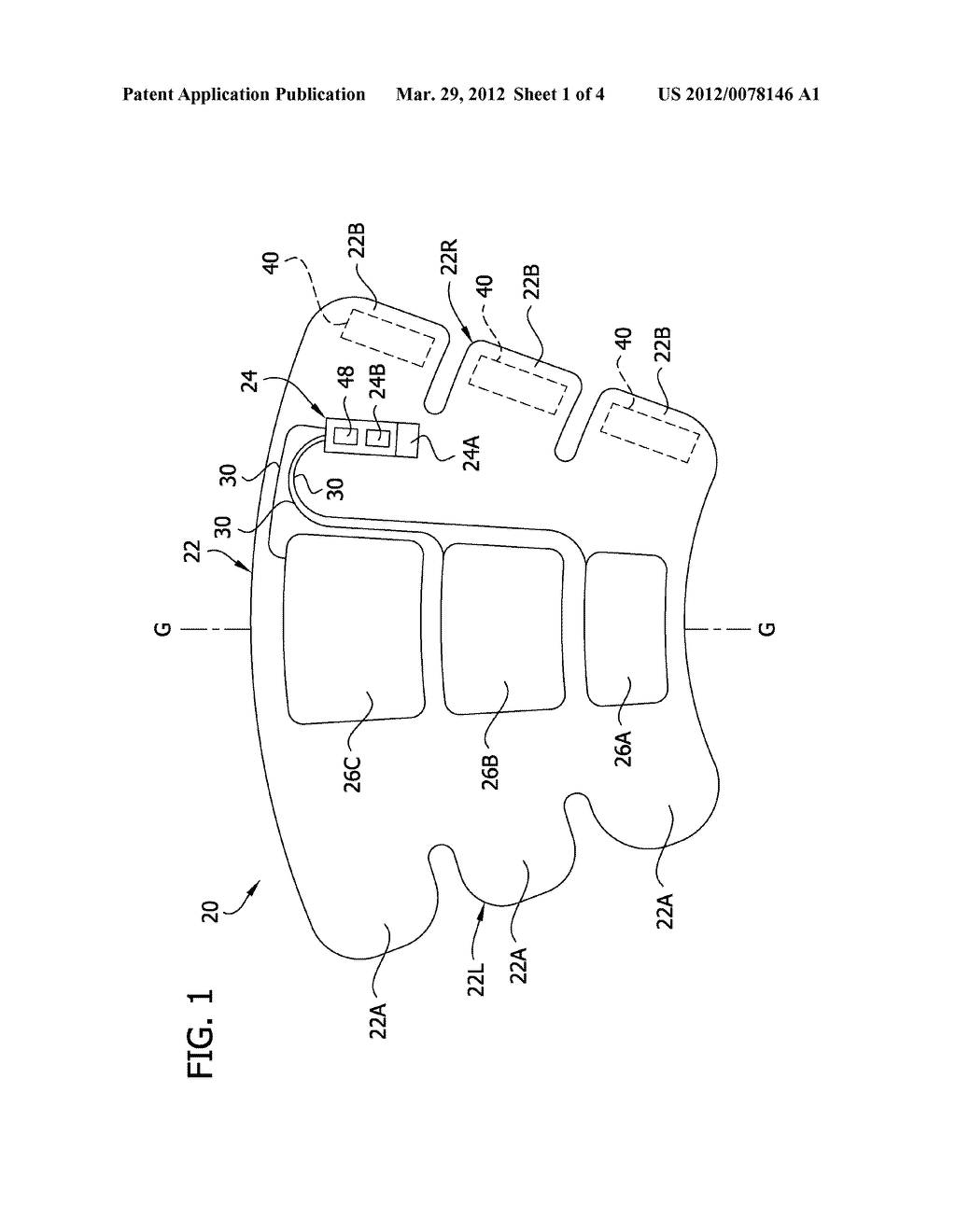 COMPRESSION GARMENT APPARATUS HAVING BASELINE PRESSURE - diagram, schematic, and image 02