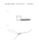 Surgical Suction Nozzle diagram and image