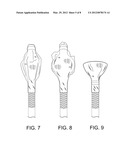 Configurable Percutaneous Endoscopic Gastrostomy Tube diagram and image