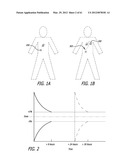 INFUSION PUMPS diagram and image