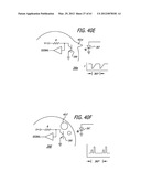 INFUSION PUMPS diagram and image