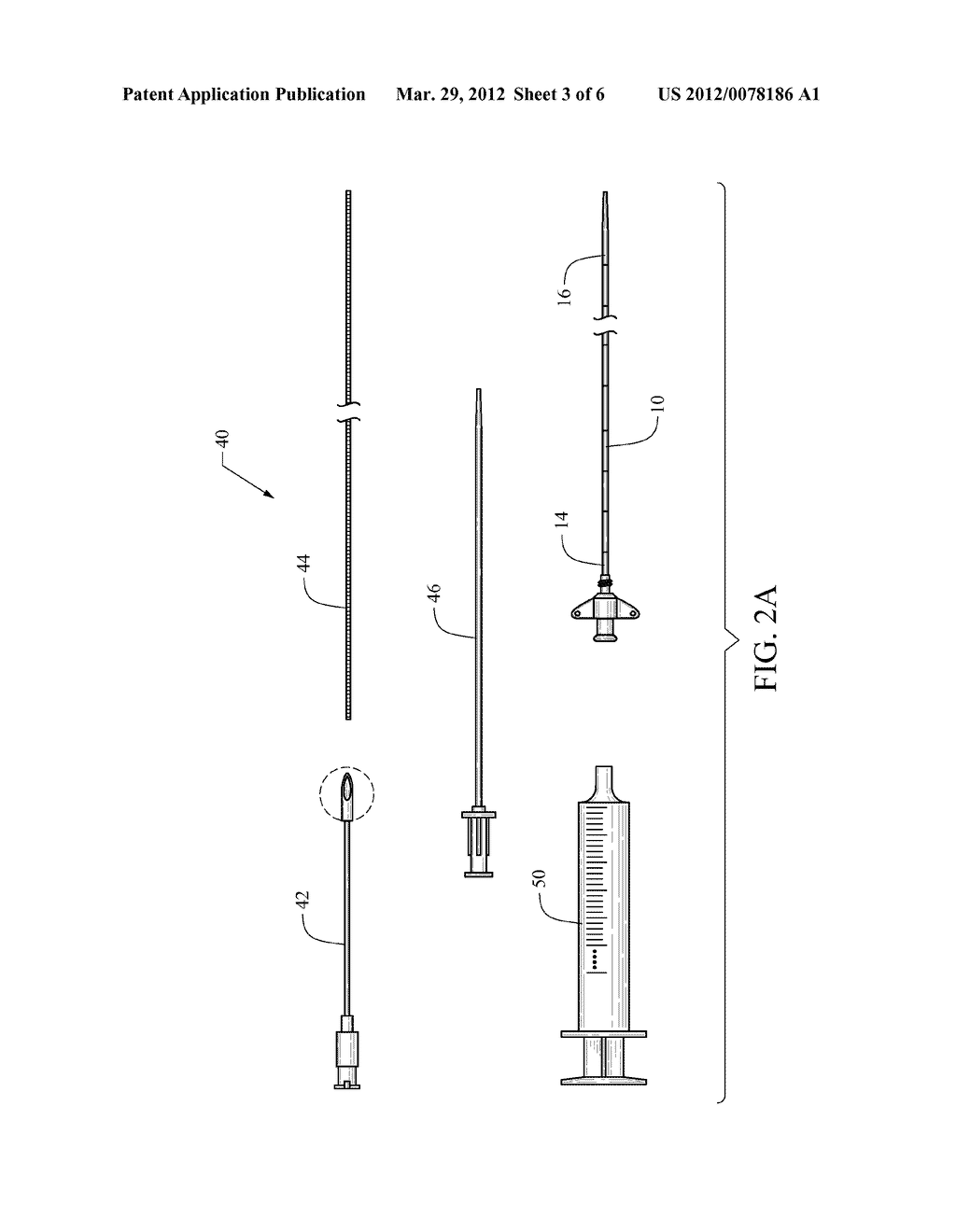 CATHETER WITH EXPANDABLE FLOW AREA - diagram, schematic, and image 04