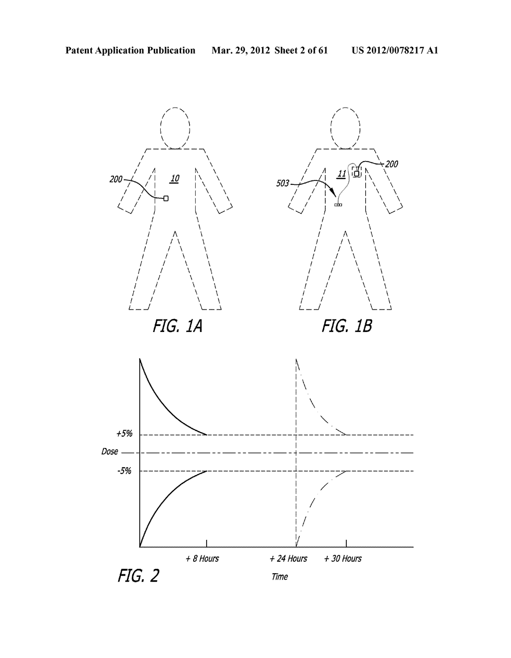 INFUSION PUMPS - diagram, schematic, and image 03