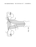 DEPLOYMENT ACTUATION SYSTEM diagram and image