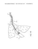 DEPLOYMENT ACTUATION SYSTEM diagram and image